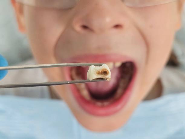 Best Emergency Dental Care for Trauma or Injury in Shippensburg, PA